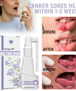 Ourlyard® Clove Oil Oral Care Spray
