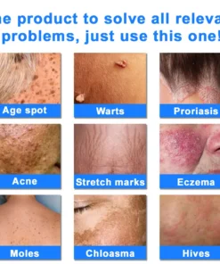 Ourlyard® Skin Treatment Cream