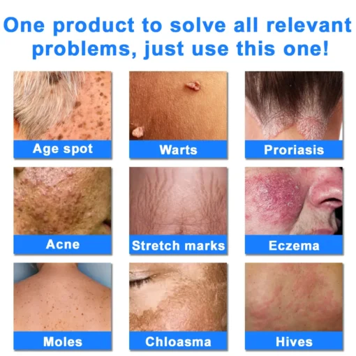 Ourlyard® Skin Treatment Cream