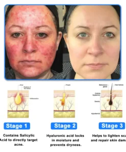 Ourlyard® Skin Treatment Cream