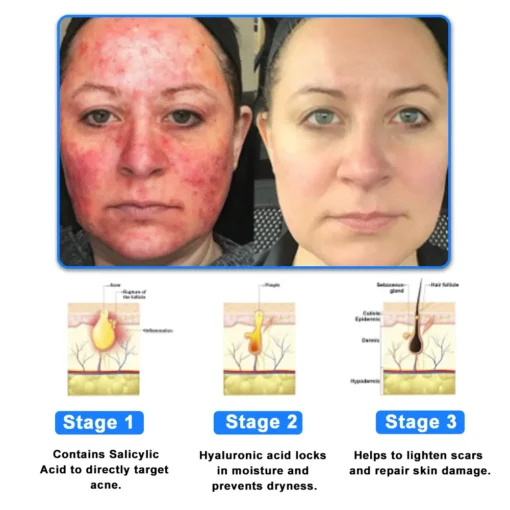 Ourlyard® Skin Treatment Cream