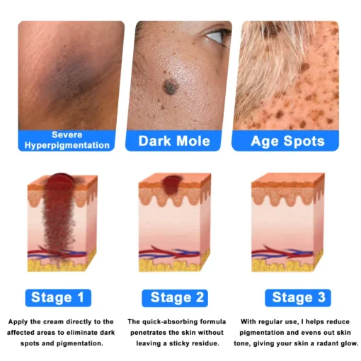 Ourlyard® Skin Treatment Cream