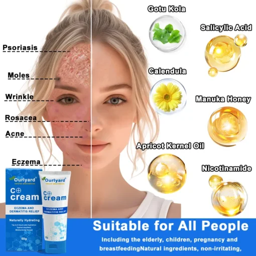 Ourlyard® Skin Treatment Cream