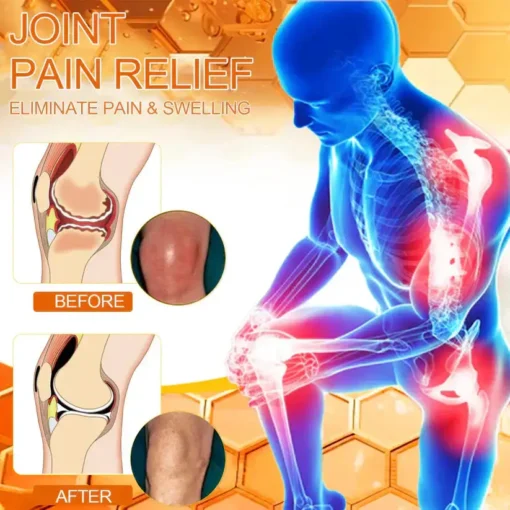 𝐎𝐮𝐫𝐥𝐲𝐚𝐫𝐝® 𝐌𝐚𝐠𝐧𝐞𝐬𝐢𝐮𝐦 & 𝐁𝐞𝐞 𝐕𝐞𝐧𝐨𝐦 𝐏𝐚𝐢𝐧—𝐑𝐞𝐥𝐢𝐞𝐟 𝐁𝐨𝐧𝐞 𝐇𝐞𝐚𝐥𝐢𝐧𝐠 𝐂𝐫𝐞𝐚𝐦