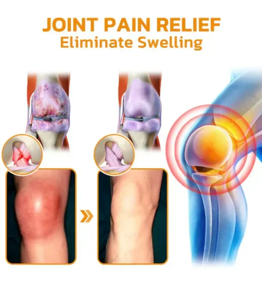 𝐎𝐮𝐫𝐥𝐲𝐚𝐫𝐝® 𝐌𝐚𝐠𝐧𝐞𝐬𝐢𝐮𝐦 & 𝐁𝐞𝐞 𝐕𝐞𝐧𝐨𝐦 𝐏𝐚𝐢𝐧—𝐑𝐞𝐥𝐢𝐞𝐟 𝐁𝐨𝐧𝐞 𝐇𝐞𝐚𝐥𝐢𝐧𝐠 𝐂𝐫𝐞𝐚𝐦