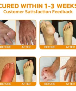 𝐎𝐮𝐫𝐥𝐲𝐚𝐫𝐝® 𝐌𝐚𝐠𝐧𝐞𝐬𝐢𝐮𝐦 & 𝐁𝐞𝐞 𝐕𝐞𝐧𝐨𝐦 𝐏𝐚𝐢𝐧—𝐑𝐞𝐥𝐢𝐞𝐟 𝐁𝐨𝐧𝐞 𝐇𝐞𝐚𝐥𝐢𝐧𝐠 𝐂𝐫𝐞𝐚𝐦
