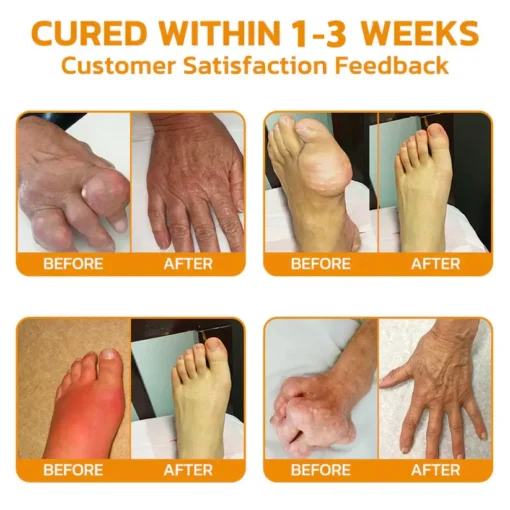 𝐎𝐮𝐫𝐥𝐲𝐚𝐫𝐝® 𝐌𝐚𝐠𝐧𝐞𝐬𝐢𝐮𝐦 & 𝐁𝐞𝐞 𝐕𝐞𝐧𝐨𝐦 𝐏𝐚𝐢𝐧—𝐑𝐞𝐥𝐢𝐞𝐟 𝐁𝐨𝐧𝐞 𝐇𝐞𝐚𝐥𝐢𝐧𝐠 𝐂𝐫𝐞𝐚𝐦