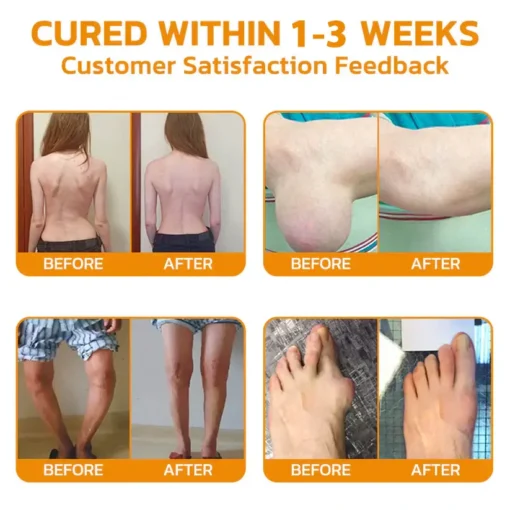 𝐎𝐮𝐫𝐥𝐲𝐚𝐫𝐝® 𝐌𝐚𝐠𝐧𝐞𝐬𝐢𝐮𝐦 & 𝐁𝐞𝐞 𝐕𝐞𝐧𝐨𝐦 𝐏𝐚𝐢𝐧—𝐑𝐞𝐥𝐢𝐞𝐟 𝐁𝐨𝐧𝐞 𝐇𝐞𝐚𝐥𝐢𝐧𝐠 𝐂𝐫𝐞𝐚𝐦