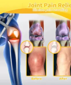 𝐎𝐮𝐫𝐥𝐲𝐚𝐫𝐝® 𝐌𝐚𝐠𝐧𝐞𝐬𝐢𝐮𝐦 & 𝐁𝐞𝐞 𝐕𝐞𝐧𝐨𝐦 𝐏𝐚𝐢𝐧—𝐑𝐞𝐥𝐢𝐞𝐟 𝐁𝐨𝐧𝐞 𝐇𝐞𝐚𝐥𝐢𝐧𝐠 𝐂𝐫𝐞𝐚𝐦