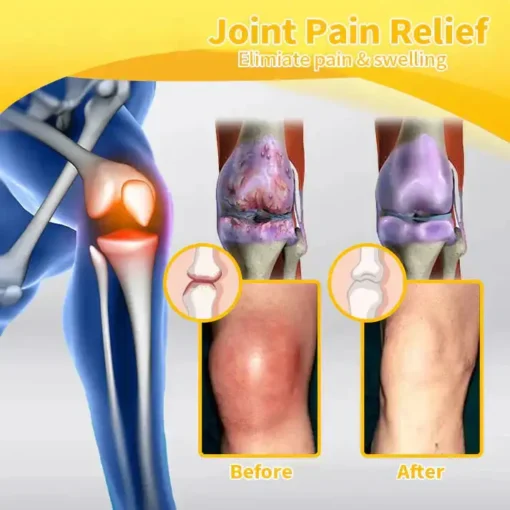 𝐎𝐮𝐫𝐥𝐲𝐚𝐫𝐝® 𝐌𝐚𝐠𝐧𝐞𝐬𝐢𝐮𝐦 & 𝐁𝐞𝐞 𝐕𝐞𝐧𝐨𝐦 𝐏𝐚𝐢𝐧—𝐑𝐞𝐥𝐢𝐞𝐟 𝐁𝐨𝐧𝐞 𝐇𝐞𝐚𝐥𝐢𝐧𝐠 𝐂𝐫𝐞𝐚𝐦