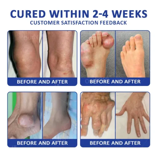 Ourlyard® Marine Sting & Emu Oil Arthritis Soothing Gel