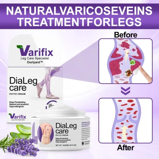 𝐎𝐮𝐫𝐥𝐲𝐚𝐫𝐝® 𝐃𝐢𝐚𝐋𝐞𝐠 𝐏𝐡𝐲𝐭𝐨 𝐂𝐫𝐞𝐚𝐦