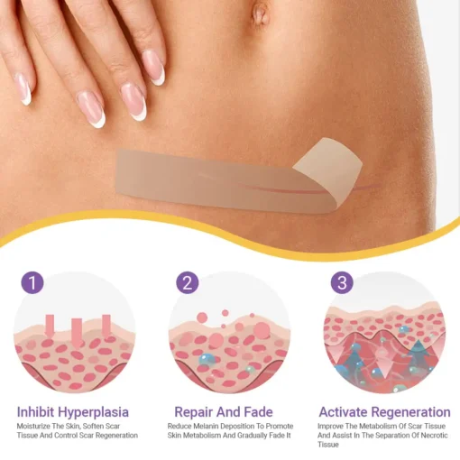 Ourlyard® Hyaluronic Acid Nano Microneedle Repair Tape