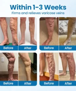 Ourlyard® Herbal Leg Spray