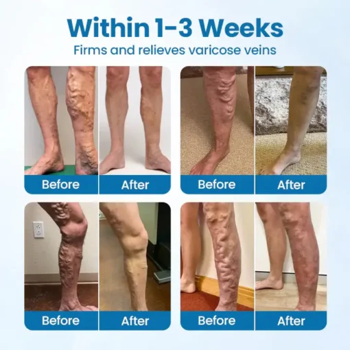 Ourlyard® Herbal Leg Spray