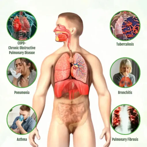 Ourlyard® Lung Detox Relief Nasal Ring