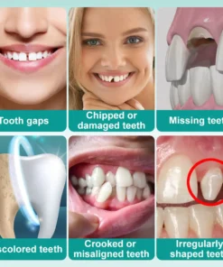 𝗢𝘂𝗿𝗹𝘆𝗮𝗿𝗱® 𝗜𝗻𝘀𝘁𝗮𝗻𝘁 𝗦𝘁𝗶𝗰𝗸-𝗼𝗻 𝗗𝗲𝗻𝘁𝗮𝗹 𝗩𝗲𝗻𝗲𝗲𝗿𝘀