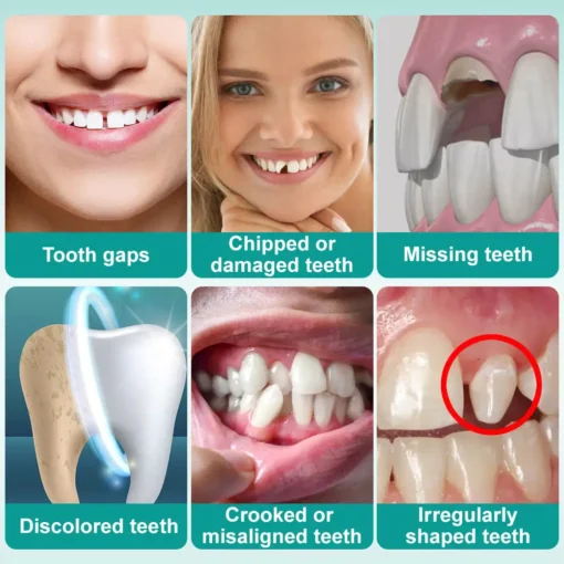 𝗢𝘂𝗿𝗹𝘆𝗮𝗿𝗱® 𝗜𝗻𝘀𝘁𝗮𝗻𝘁 𝗦𝘁𝗶𝗰𝗸-𝗼𝗻 𝗗𝗲𝗻𝘁𝗮𝗹 𝗩𝗲𝗻𝗲𝗲𝗿𝘀