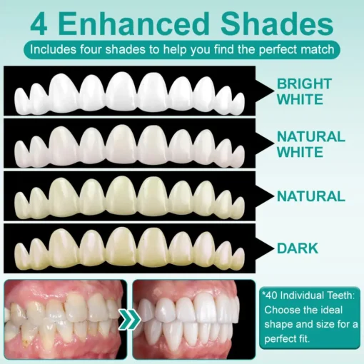 𝗢𝘂𝗿𝗹𝘆𝗮𝗿𝗱® 𝗜𝗻𝘀𝘁𝗮𝗻𝘁 𝗦𝘁𝗶𝗰𝗸-𝗼𝗻 𝗗𝗲𝗻𝘁𝗮𝗹 𝗩𝗲𝗻𝗲𝗲𝗿𝘀