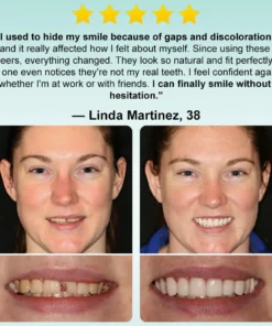 𝗢𝘂𝗿𝗹𝘆𝗮𝗿𝗱® 𝗜𝗻𝘀𝘁𝗮𝗻𝘁 𝗦𝘁𝗶𝗰𝗸-𝗼𝗻 𝗗𝗲𝗻𝘁𝗮𝗹 𝗩𝗲𝗻𝗲𝗲𝗿𝘀