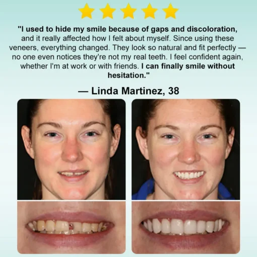 𝗢𝘂𝗿𝗹𝘆𝗮𝗿𝗱® 𝗜𝗻𝘀𝘁𝗮𝗻𝘁 𝗦𝘁𝗶𝗰𝗸-𝗼𝗻 𝗗𝗲𝗻𝘁𝗮𝗹 𝗩𝗲𝗻𝗲𝗲𝗿𝘀