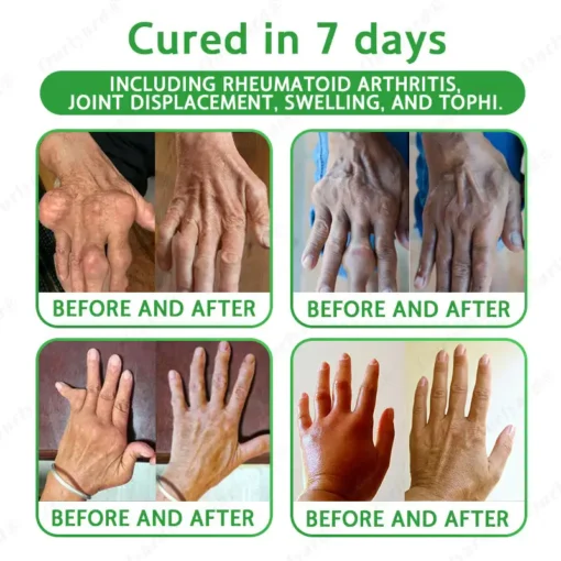 Ourlyard® Advanced Magnesium & Emu Oil Massage Pain Relief Gel
