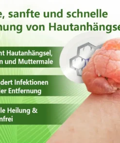 Ourlyard® Magnesium MicroNeedle Schnell Entfernen Hautmal-Pflaster