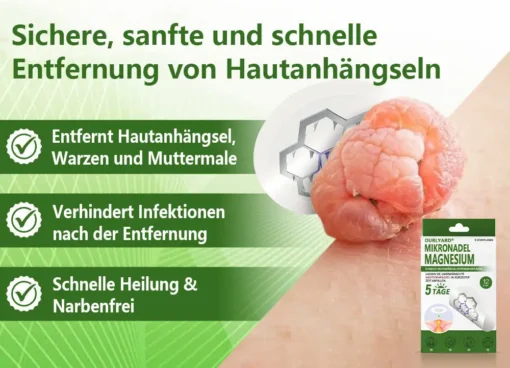 Ourlyard® Magnesium MicroNeedle Schnell Entfernen Hautmal-Pflaster