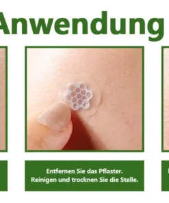 Ourlyard® Magnesium MicroNeedle Schnell Entfernen Hautmal-Pflaster