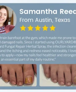 Ourlyard® NailGuard Fungal Repair Herbal Spray