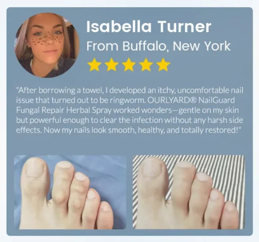 Ourlyard® NailGuard Fungal Repair Herbal Spray