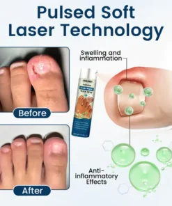 Ourlyard® NailGuard Fungal Repair Herbal Spray
