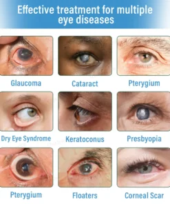 Ourlyard® Supramolecular Eye Drops