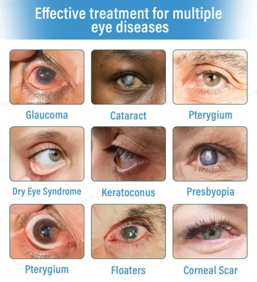 Ourlyard® Supramolecular Eye Drops