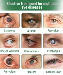 Ourlyard® ClariTech Nano Eye Drops