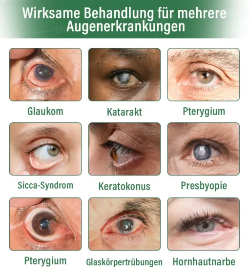 Ourlyard® OptiClear DualTech Augentropfen