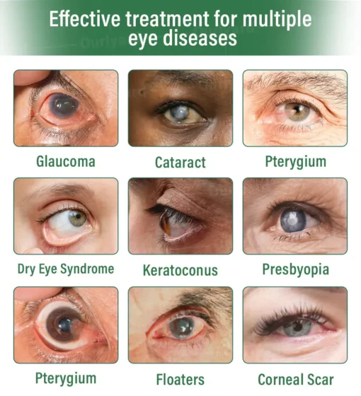 Ourlyard® OptiClear DualTech Eye Drops