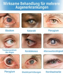 Ourlyard® Supramolekulare Augentropfen
