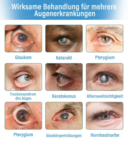 Ourlyard® Supramolekulare Augentropfen