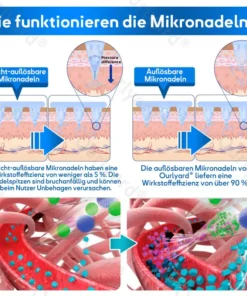 𝐎𝐮𝐫𝐥𝐲𝐚𝐫𝐝® 𝐓𝐢𝐫𝐳𝐞𝐩𝐚𝐭𝐢𝐝-𝐍𝐚𝐧𝐨𝐩𝐟𝐥𝐚𝐬𝐭𝐞𝐫
