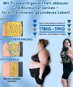 𝐎𝐮𝐫𝐥𝐲𝐚𝐫𝐝® 𝐓𝐢𝐫𝐳𝐞𝐩𝐚𝐭𝐢𝐝-𝐍𝐚𝐧𝐨𝐩𝐟𝐥𝐚𝐬𝐭𝐞𝐫