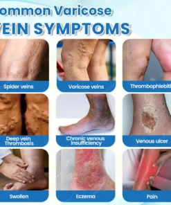 Ourlyard® VascuCare Vein Healing Spray