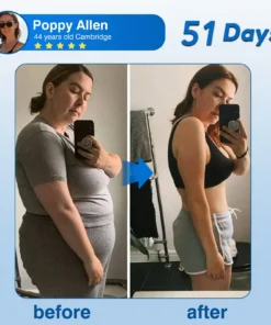 𝐎𝐮𝐫𝐥𝐲𝐚𝐫𝐝® 𝐓𝐢𝐫𝐳𝐞𝐩𝐚𝐭𝐢𝐝𝐞 𝐍𝐚𝐧𝐨 𝐏𝐚𝐭𝐜𝐡 ✅Gentle GLP-1 Support for Women | Balance Hormones, Blood Sugar & Weight Naturally 𝐎𝐮𝐫𝐥𝐲𝐚𝐫𝐝® 𝐓𝐢𝐫𝐳𝐞𝐩𝐚𝐭𝐢𝐝𝐞 𝐍𝐚𝐧𝐨 𝐏𝐚𝐭𝐜𝐡