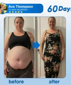 𝐎𝐮𝐫𝐥𝐲𝐚𝐫𝐝® 𝐓𝐢𝐫𝐳𝐞𝐩𝐚𝐭𝐢𝐝𝐞 𝐍𝐚𝐧𝐨 𝐏𝐚𝐭𝐜𝐡 ✅Gentle GLP-1 Support for Women | Balance Hormones, Blood Sugar & Weight Naturally 𝐎𝐮𝐫𝐥𝐲𝐚𝐫𝐝® 𝐓𝐢𝐫𝐳𝐞𝐩𝐚𝐭𝐢𝐝𝐞 𝐍𝐚𝐧𝐨 𝐏𝐚𝐭𝐜𝐡