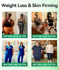 Ourlyard™ 𝙈𝒐𝒓𝒊𝒏𝒈𝗮 𝗕𝗲𝗿𝗯𝐞𝐫𝐢𝐧𝙚 𝙉𝑨𝑫 𝟏𝟎-𝙞𝙣-𝟏 𝘼𝒅𝒗𝒂𝒏𝒄𝒆𝐝 𝐍𝐚𝐧𝙤 𝙈𝙞𝙘𝙧𝙤𝙣𝒆𝒆𝒅𝒍𝐞 𝐏𝐚𝐭𝙘𝙝(𝐉𝐮𝐬𝐭 𝐨𝐧𝐜𝐞 𝐚 𝐝𝐚𝐲. 𝐯𝐢𝐬𝐢𝐛𝐥𝐞 𝐜𝐡𝐚𝐧𝐠𝐞𝐬 𝐢𝐧 𝟕 𝐝𝐚𝐲𝐬) 𝐅𝐨𝐫 𝐨𝐛𝐞𝐬𝐢𝐭𝐲. .𝐝𝐢𝐚𝐛𝐞𝐭𝐞𝐬. 𝐬𝐥𝐞𝐞𝐩 𝐚𝐩𝐧𝐞𝐚. 𝐣𝐨𝐢𝐧𝐭 𝐢𝐬𝐬𝐮𝐞𝐬. 𝐚𝐧𝐝 𝐦𝐨𝐫𝐞