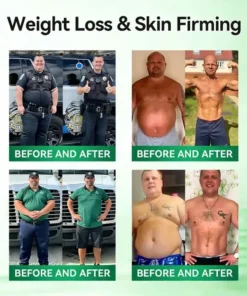 Ourlyard™ 𝙈𝒐𝒓𝒊𝒏𝒈𝗮 𝗕𝗲𝗿𝗯𝐞𝐫𝐢𝐧𝙚 𝙉𝑨𝑫 𝟏𝟎-𝙞𝙣-𝟏 𝘼𝒅𝒗𝒂𝒏𝒄𝒆𝐝 𝐍𝐚𝐧𝙤 𝙈𝙞𝙘𝙧𝙤𝙣𝒆𝒆𝒅𝒍𝐞 𝐏𝐚𝐭𝙘𝙝(𝐉𝐮𝐬𝐭 𝐨𝐧𝐜𝐞 𝐚 𝐝𝐚𝐲. 𝐯𝐢𝐬𝐢𝐛𝐥𝐞 𝐜𝐡𝐚𝐧𝐠𝐞𝐬 𝐢𝐧 𝟕 𝐝𝐚𝐲𝐬) 𝐅𝐨𝐫 𝐨𝐛𝐞𝐬𝐢𝐭𝐲. .𝐝𝐢𝐚𝐛𝐞𝐭𝐞𝐬. 𝐬𝐥𝐞𝐞𝐩 𝐚𝐩𝐧𝐞𝐚. 𝐣𝐨𝐢𝐧𝐭 𝐢𝐬𝐬𝐮𝐞𝐬. 𝐚𝐧𝐝 𝐦𝐨𝐫𝐞